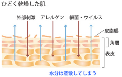 ひどく感想した肌